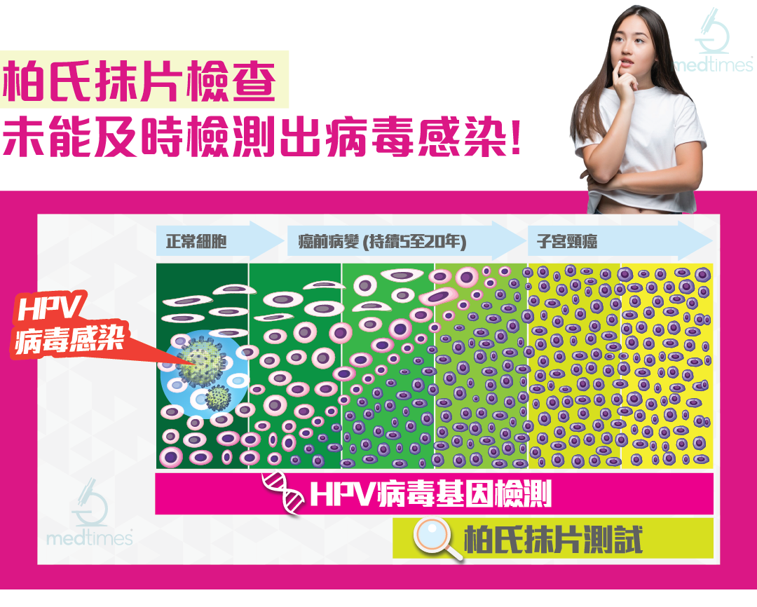HPV43 病毒基因檢測